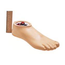 Foot with CFRP support module