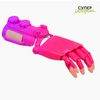 Active hand prosthesis "Kibi" - a technical means of rehabilitation